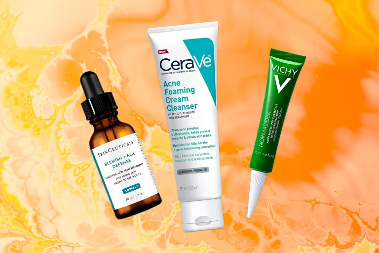 What You Should Learn About Acne Treatments
